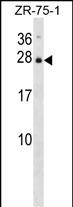Rabbit Polyclonal Antibody to IL25