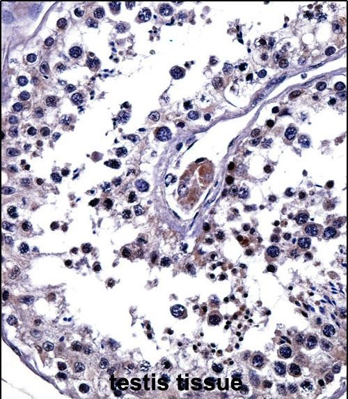 Rabbit Polyclonal Antibody to IL25