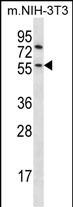 Rabbit Polyclonal Antibody to Mouse Gsk3b (N-term)
