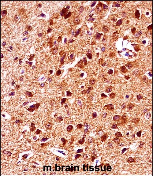 Rabbit Polyclonal Antibody to Mouse Gsk3b (N-term)