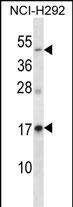 Rabbit Polyclonal Antibody to RAMP3