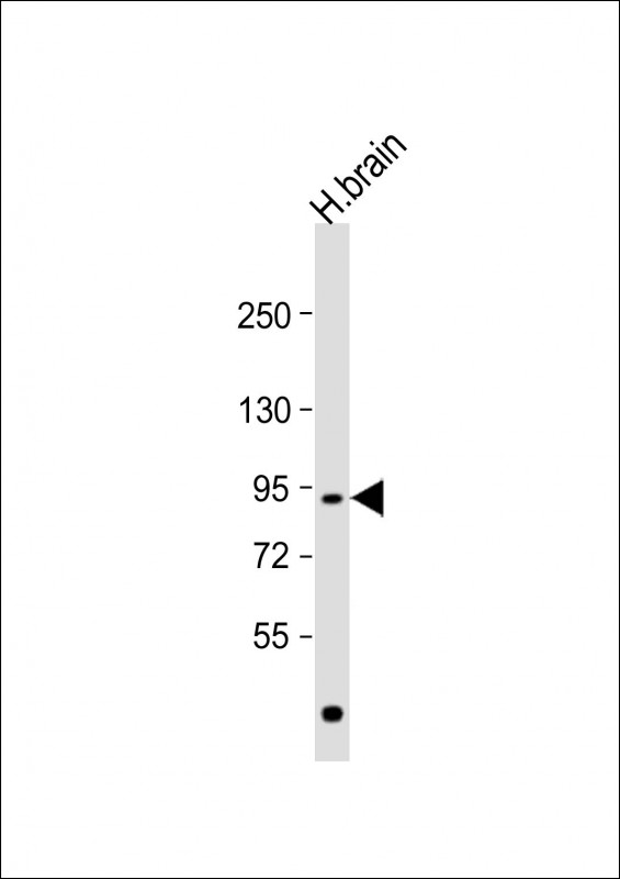 NLGN4Y (N-term)