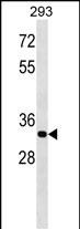 Rabbit Polyclonal Antibody to ELOVL4