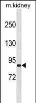Rabbit Polyclonal Antibody to SEMA4A (N-term)