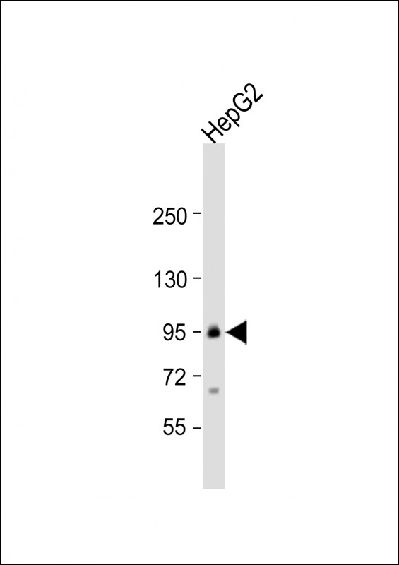 TRPC1