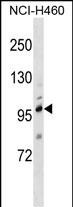 Rabbit Polyclonal Antibody to TRPC1
