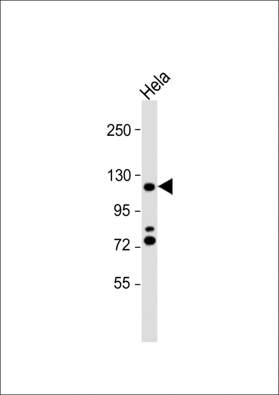 HIRA (N-term)