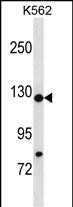 Rabbit Polyclonal Antibody to HIRA (N-term)