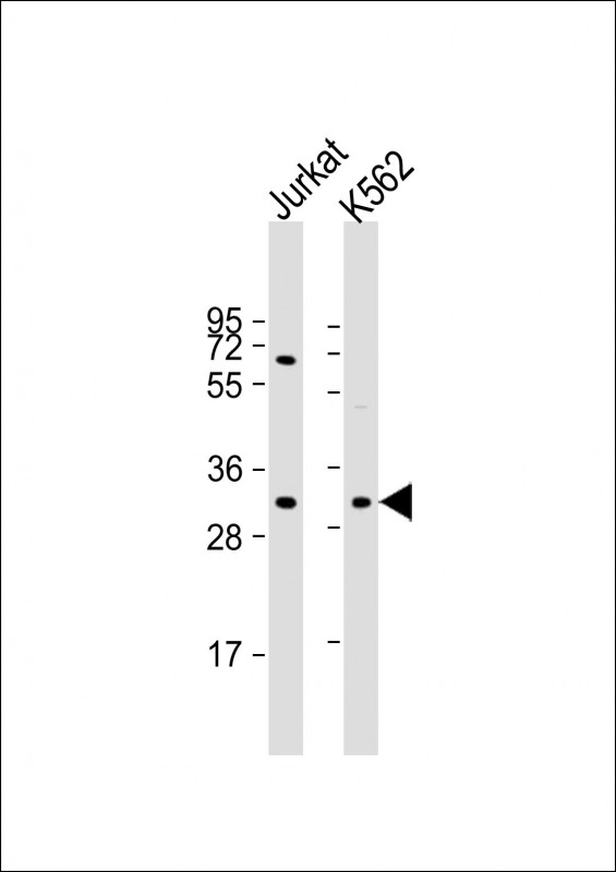 TP53RK