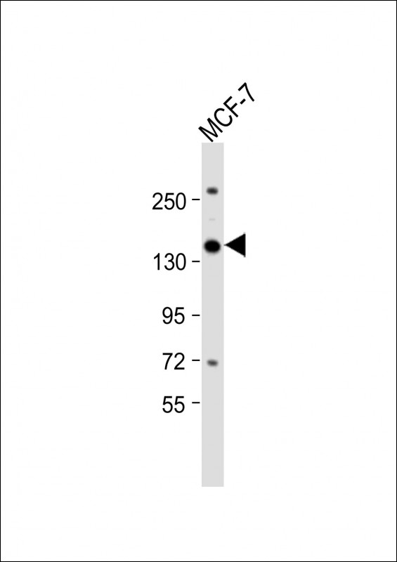 NCAPG2