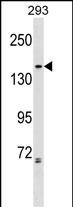 Rabbit Polyclonal Antibody to NCAPG2
