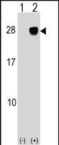 Rabbit Polyclonal Antibody to ULBP2
