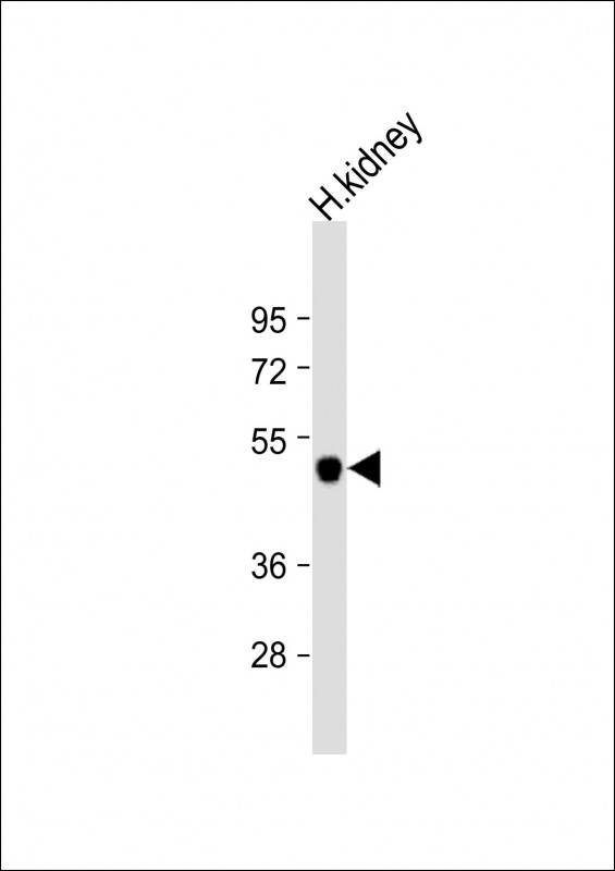 KCNJ15