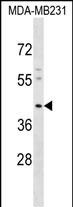 Rabbit Polyclonal Antibody to KCNJ15