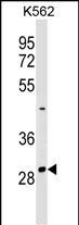 Rabbit Polyclonal Antibody to NRIP2