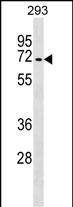 Rabbit Polyclonal Antibody to Mouse Tgfbr2