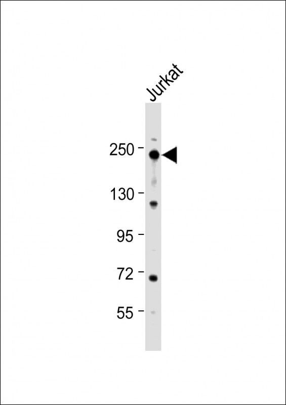 ERCC5