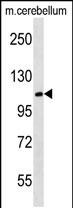 Rabbit Polyclonal Antibody to MBD6