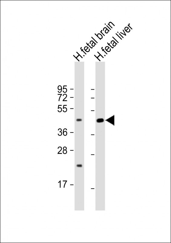 SLC30A10