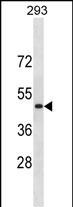 Rabbit Polyclonal Antibody to RNF135(C-term)