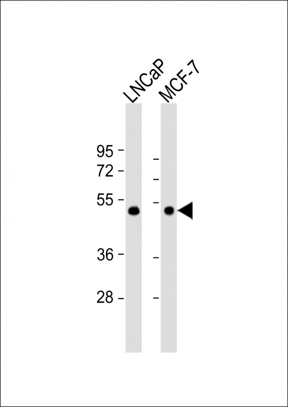 TXNIP(N-term)