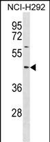 Rabbit Polyclonal Antibody to TXNIP(N-term)