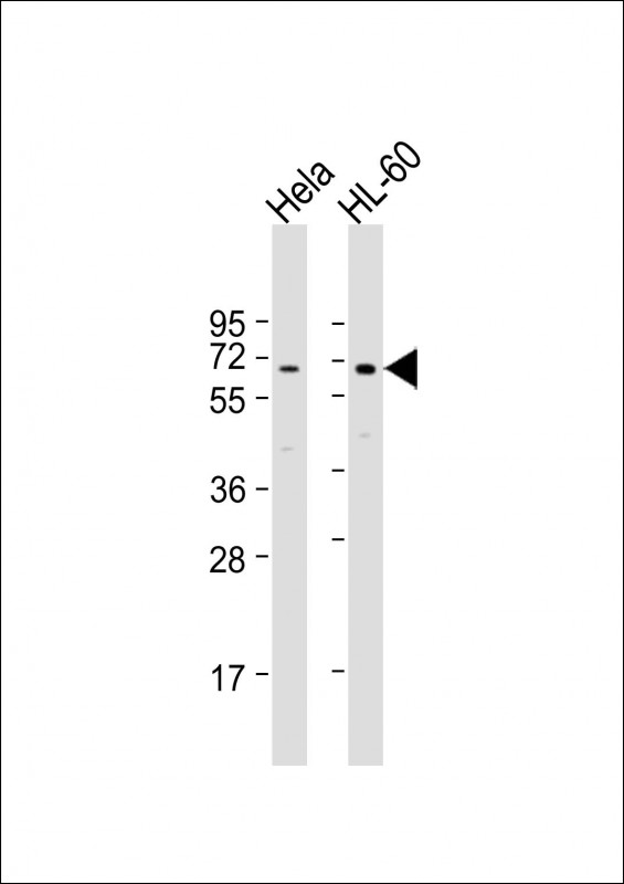 PIGB (N-term)