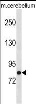 Rabbit Polyclonal Antibody to NSF