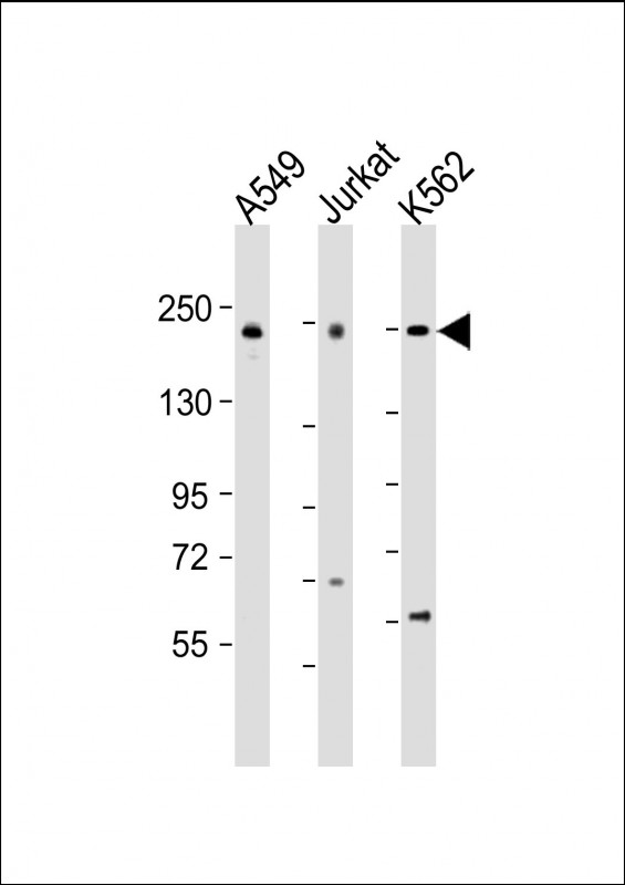 PSME4 (N-Term)
