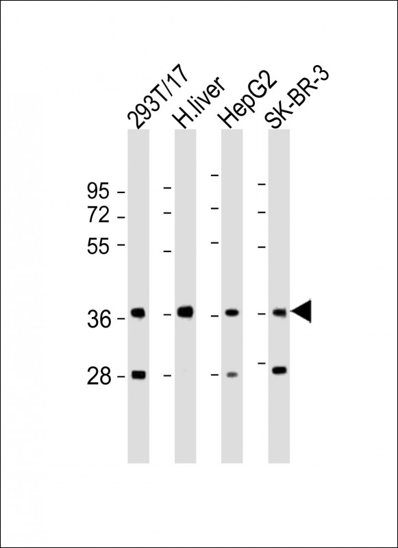 AKR7A3 (N-Term)