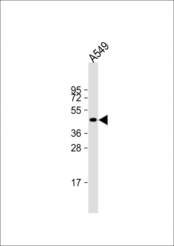 NAT16 (N-Term)