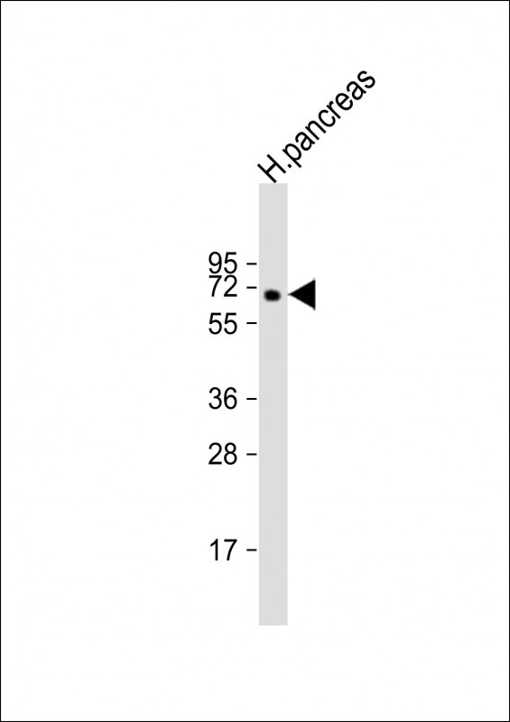 MGAT4B (N-Term)