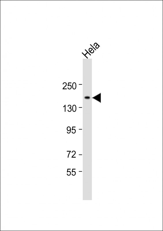 CHD5 (N-Term)