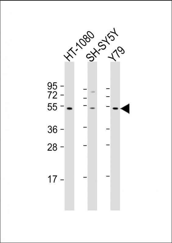 ZNF513 (N-Term)
