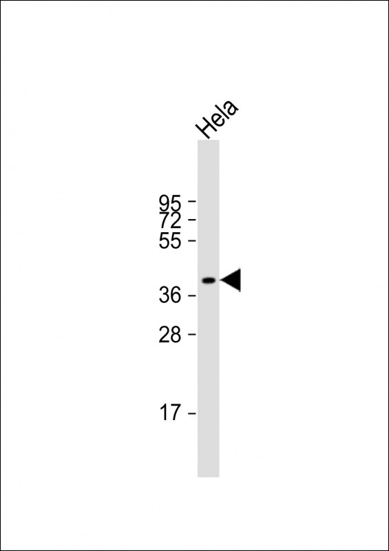 LPGAT1