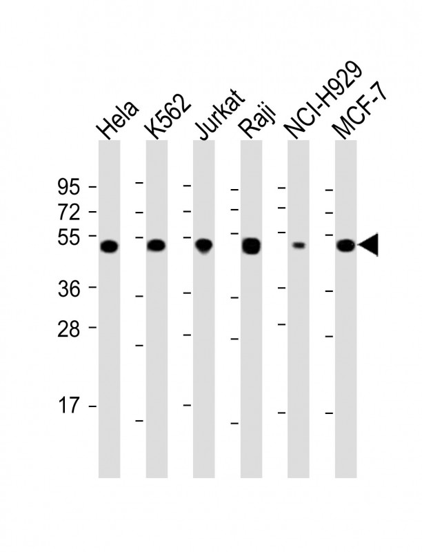 RPL4 (N-Term)