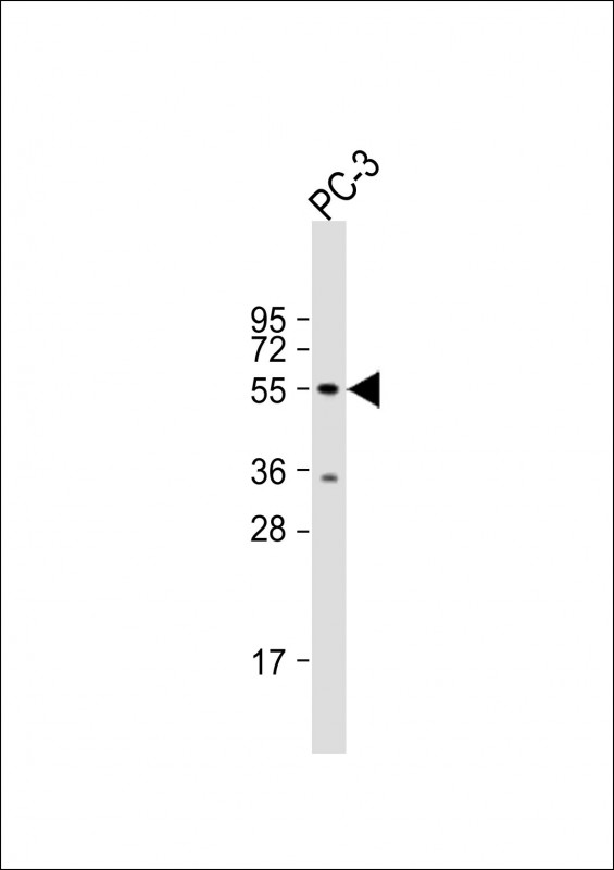 RNF36 (TRIM69) (Center H215)