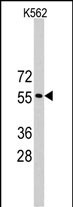 Rabbit Polyclonal Antibody to RNF36 (TRIM69) (Center H215)