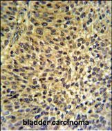 Rabbit Polyclonal Antibody to FUT6