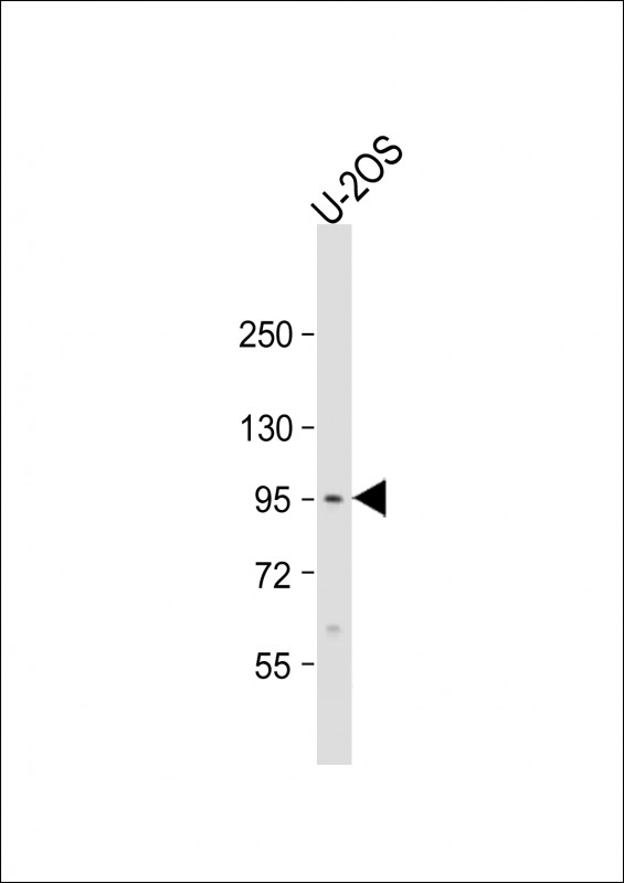 EPC2 (N-term)
