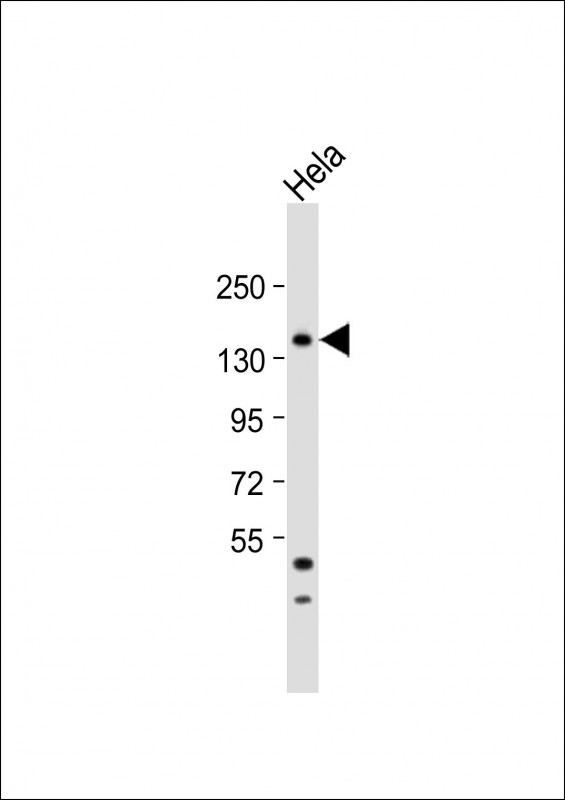 MTMR15  (N-term)