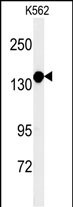 Rabbit Polyclonal Antibody to MTMR15  (N-term)