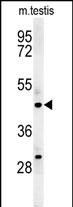 Rabbit Polyclonal Antibody to STAMBPL1