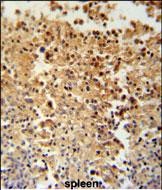 Rabbit Polyclonal Antibody to STAMBPL1