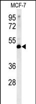 Rabbit Polyclonal Antibody to LSP1