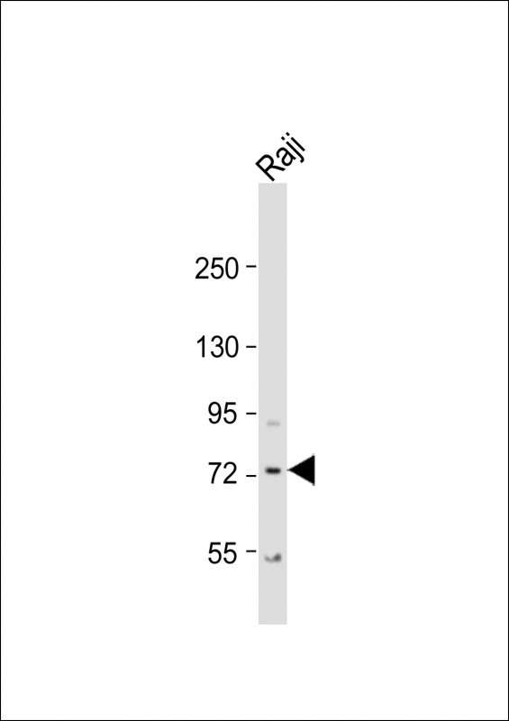 KLHL6  (C-term)