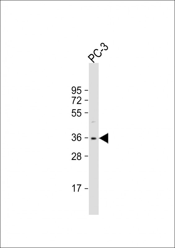 OTUD6B