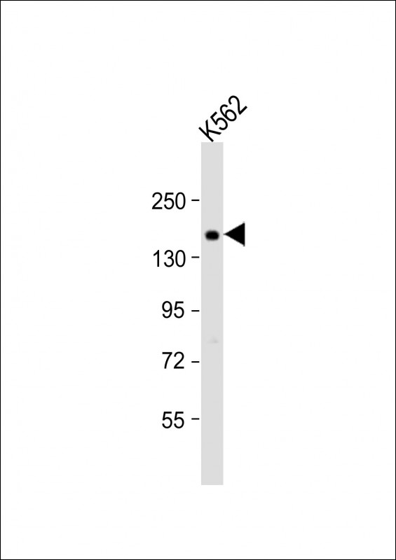 ADCY10