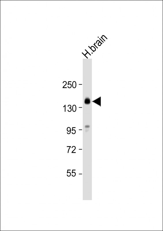 SLC12A5 (N-term)