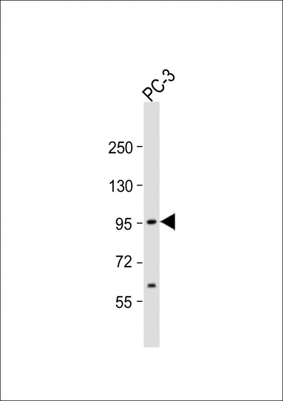 ST14